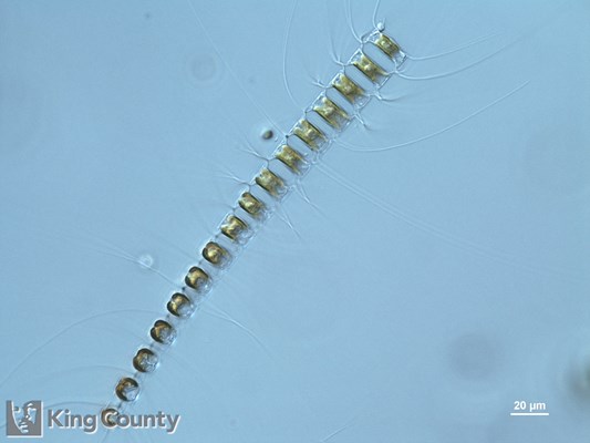 Photo of Chaetoceros diadema